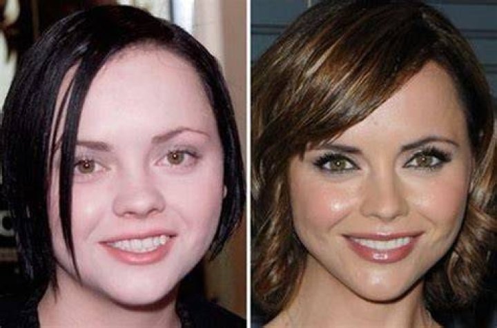 Christina Ricci Plastic Surgery Before and After