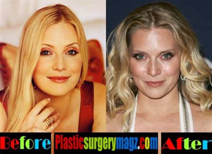 Emily Procter Breast Implants Plastic Surgery Before and After