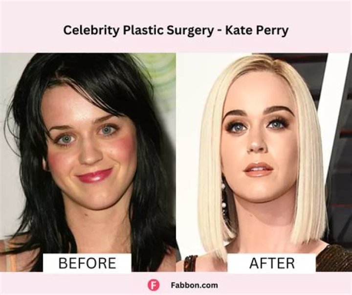 Kate Mara Plastic Surgery Before and After