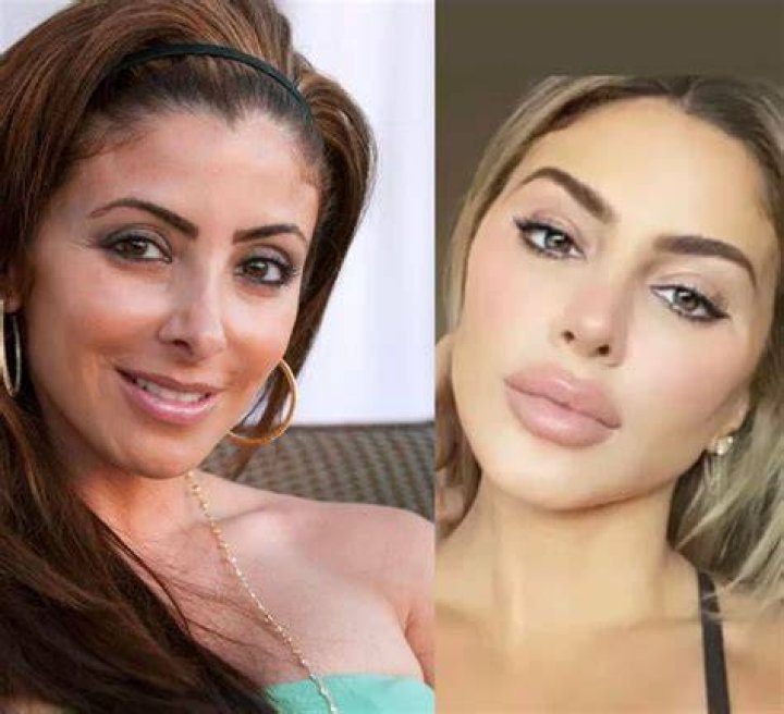 larsa pippen plastic surgery