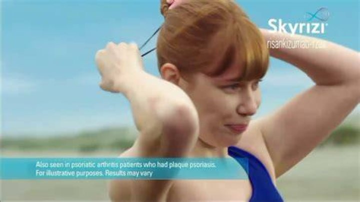 Skyrizi Commercial Actress 2023: Dana Deggs