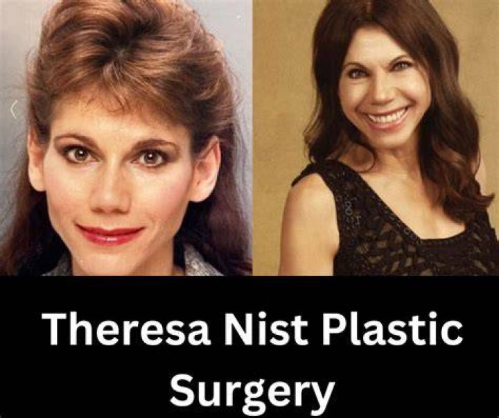 Theresa Nist Plastic Surgery: Reviewing Her Appearance from Several Points of View!