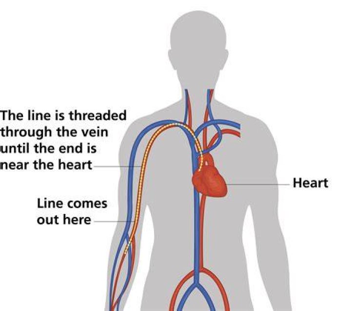 Why is a PICC line inserted into the heart?